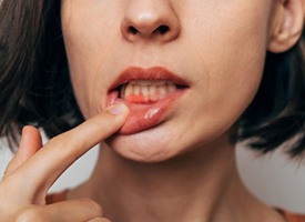 Lady shows inflamed gum tissue