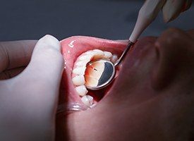 Side by side illustration showing healthy gums vs diseased gums