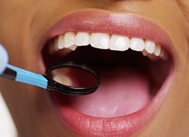 Closeup of healthy smile