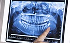 Digital dental x-rays