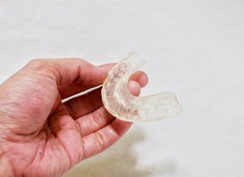 Holding occlusal splint for TMJ treatment in Acworth, GA