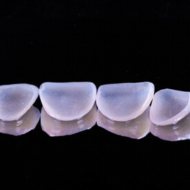 Veneers on black background