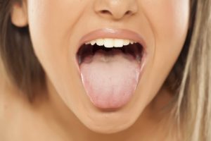 Woman with blond hair asking her dentist, Should I Scrape My Tongue?