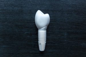 Metal-free dental implant