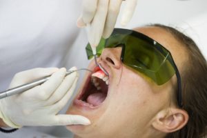 Woman undergoing laser gum recontouring