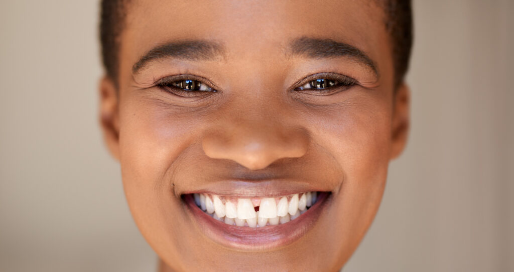 Woman smiling with gap in teeth