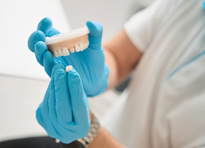 Dentist showing model of a dental crown